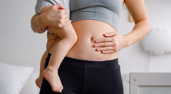 Cesarean Section Day